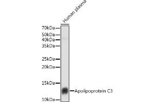 Western blot analysis of extracts of Human plasma cells, using Apolipoprotein C3 antibody (ABIN7265640) at 1:1000 dilution. (APOC3 Antikörper)