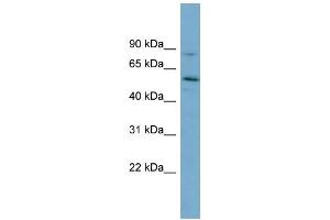 WB Suggested Anti-SNTG1 Antibody Titration: 0. (Syntrophin gamma 1 Antikörper  (Middle Region))