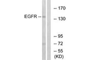 Western Blotting (WB) image for anti-Epidermal Growth Factor Receptor (EGFR) (AA 1161-1210) antibody (ABIN2888976) (EGFR Antikörper  (AA 1161-1210))