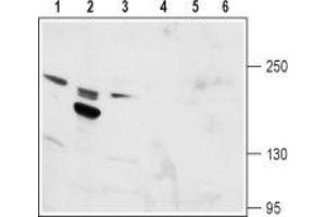 Western blot analysis of rat kidney (lanes 1 and 4), rat testis (lanes 2 and 5) and mouse kidney (lanes 3 and 6) lysates: - 1-3. (TRPM6 Antikörper  (1st Extracellular Loop))