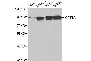 Western Blotting (WB) image for anti-Carnitine Palmitoyltransferase 1A (Liver) (CPT1A) antibody (ABIN1876495) (CPT1A Antikörper)