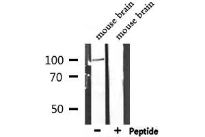 Western blot analysis of extracts from mouse brain, using DLG1 Antibody. (DLG1 Antikörper  (Internal Region))