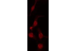 ABIN6274233 staining Hela cells by IF/ICC. (GTF2H1 Antikörper  (N-Term))