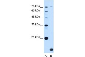 WB Suggested Anti-TMEM91 Antibody Titration:  0.