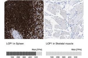 Immunohistochemical staining (Formalin-fixed paraffin-embedded sections) of human spleen and skeletal muscle tissues. (LCP1 Antikörper  (AA 18-77))