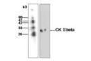 Image no. 1 for anti-Casein Kinase 2, beta (CSNK2B) antibody (ABIN791462) (CSNK2B Antikörper)