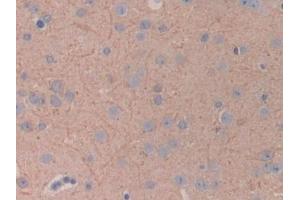 Immunohistochemistry (IHC) image for anti-Pyruvate Dehydrogenase Kinase, Isozyme 4 (PDK4) (AA 117-387) antibody (ABIN7439630)