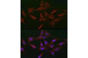 Immunofluorescence analysis of NIH/3T3 cells using A Rabbit pAb (ABIN3015791, ABIN3015792, ABIN3015793 and ABIN6219141) at dilution of 1:50 (40x lens).
