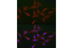 Immunofluorescence analysis of NIH/3T3 cells using A Rabbit pAb (ABIN3015791, ABIN3015792, ABIN3015793 and ABIN6219141) at dilution of 1:50 (40x lens). (ACVR2A Antikörper  (AA 20-140))