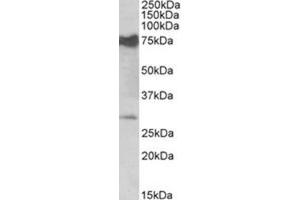AP31405PU-N NMNAT3 antibody staining of Mouse Heart lysate at 0. (NMNAT3 Antikörper  (Internal Region))