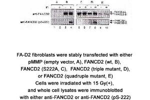 Image no. 2 for anti-Fanconi Anemia, Complementation Group D2 (FANCD2) (AA 217-226), (pSer222) antibody (ABIN363448) (FANCD2 Antikörper  (pSer222))