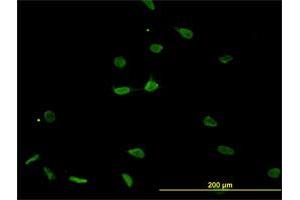 Immunofluorescence of monoclonal antibody to PSMB8 on HeLa cell. (PSMB8 Antikörper  (AA 173-272))