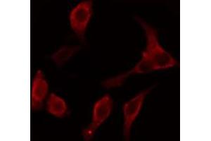 ABIN6274647 staining LOVO cells by IF/ICC. (Cytochrome P450 2C8/9/18/19 Antikörper)