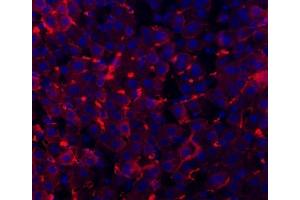 IF analysis of TAPA1/CD81 using anti-TAPA1/CD81 antibody (ABIN5693258). (CD81 Antikörper  (AA 116-201))