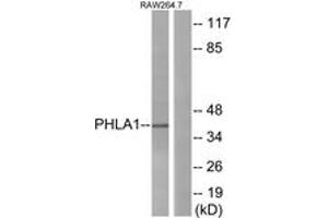 Western blot analysis of extracts from RAW264. (PHLDA1 Antikörper  (AA 271-320))