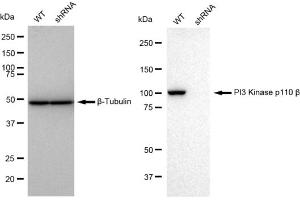 Western blotting analysis using PI3 Kinase p110 beta antibody (ABIN7799817). (Rekombinanter PIK3CB Antikörper)