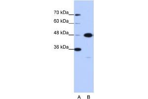 WB Suggested Anti-GTPBP9 Antibody Titration:  0. (OLA1 Antikörper  (N-Term))