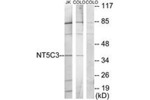 Western blot analysis of extracts from Jurkat/COLO205 cells, using NT5C3 Antibody. (NT5C3 Antikörper  (AA 11-60))