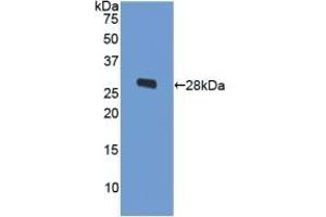 Detection of Recombinant ODC, Human using Polyclonal Antibody to Ornithine Decarboxylase (ODC) (ODC1 Antikörper  (AA 15-259))