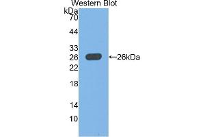 Detection of Recombinant UCHL1, Rat using Polyclonal Antibody to Ubiquitin Carboxyl Terminal Hydrolase L1 (UCHL1) (UCHL1 Antikörper  (AA 2-223))