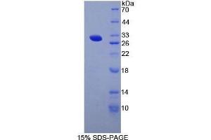 SDS-PAGE (SDS) image for Thyroglobulin (TG) (AA 2083-2333) protein (His tag) (ABIN1878549) (Thyroglobulin Protein (TG) (AA 2083-2333) (His tag))