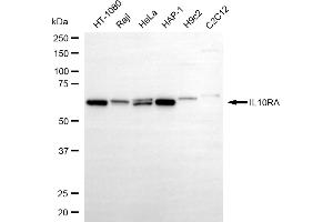 Western blotting analysis using IL10RA antibody (ABIN7799096).