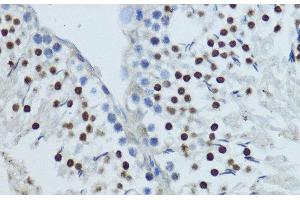 Immunohistochemistry of paraffin-embedded Rat testis using NR1I3 Polyclonal Antibody at dilution of 1:200 (40x lens). (NR1I3 Antikörper)