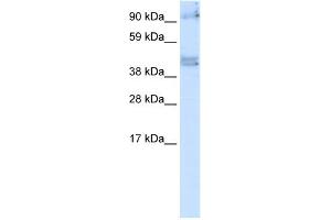 WB Suggested Anti-SIRT2 Antibody   Titration: 5 ug/ml   Positive Control: Fetal Brain (SIRT2 Antikörper  (N-Term))