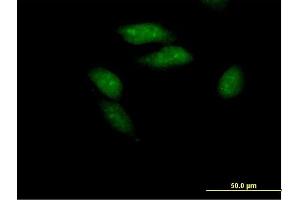 Immunofluorescence of purified MaxPab antibody to PCGF3 on HeLa cell. (PCGF3 Antikörper  (AA 1-242))