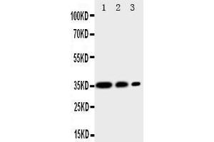 Anti-CD163 antibody,  Western blotting All lanes: Anti CD163 () at 0.
