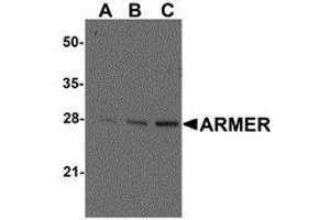 Western blot ana-lysis of ARMER in mouse small intestine tissue lysates with AP30081PU-N ARMER antibody at (A) 0.