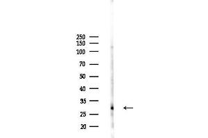 Western blot analysis of lysates from HUVEC cells(LPS 4h treatment), using CRISP1 Antibody at 1/1000 dilution.
