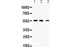 Western blot analysis of Beta III Tubulin expression in rat brian extract ( Lane 1), mouse brain extract ( Lane 2) and HELA whole cell lysates ( Lane 3). (TUBB3 Antikörper  (C-Term))