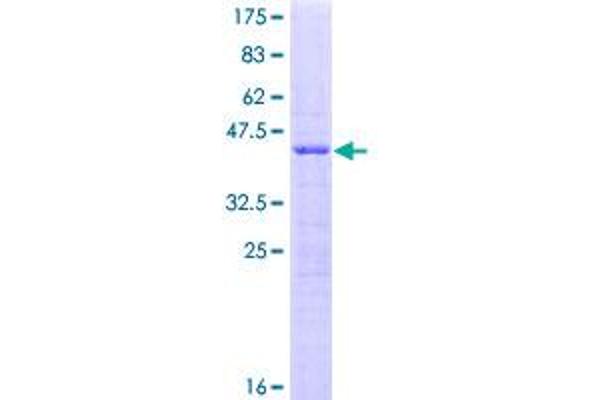 SRP19 Protein (AA 1-144) (GST tag)