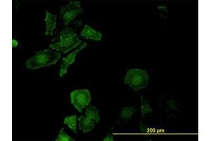 Image no. 2 for anti-Leucine Proline-Enriched Proteoglycan (Leprecan) 1 (LEPRE1) (AA 1-100) antibody (ABIN599294) (LEPRE1 Antikörper  (AA 1-100))