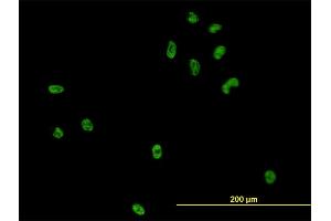 Immunofluorescence of monoclonal antibody to CSE1L on HeLa cell. (Exportin 2 Antikörper  (AA 872-971))