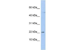 WB Suggested Anti-C19orf25 Antibody Titration:  0. (C19orf25 Antikörper  (N-Term))