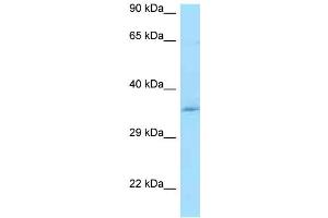 WB Suggested Anti-CCDC117 Antibody Titration: 1. (CCDC117 Antikörper  (Middle Region))