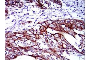 Immunohistochemistry (IHC) image for anti-Keratin 5 (KRT5) antibody (ABIN1845565) (Cytokeratin 5 Antikörper)