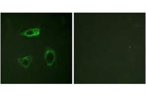 Immunofluorescence analysis of HepG2 cells, using CD18/ITGB2 (Phospho-Thr758) Antibody. (Integrin beta 2 Antikörper  (pThr758))