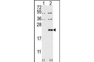 Western blot analysis of DUSP13 (arrow) using DUSP13-M1 Antibody (N-term) (ABIN392875 and ABIN2842283). (DUSP13-M1 (AA 1-30), (N-Term) Antikörper)