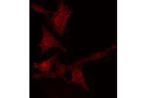 ABIN6275547 staining  Hela cells by IF/ICC. (PPP2R5D Antikörper  (C-Term))
