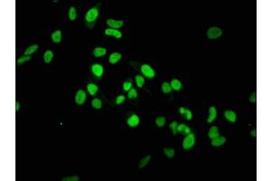 Immunofluorescence staining of Hela cells with ABIN7127301 at 1:37. (Rekombinanter HIST1H3A Antikörper  (H3K36me))