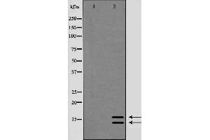 Western blot analysis of lc3A/Bexpression in HeLa whole cell lysate.