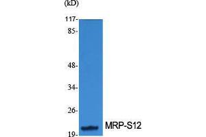 Western Blotting (WB) image for anti-Mitochondrial Ribosomal Protein S34 (MRPS34) (Internal Region) antibody (ABIN3185671)