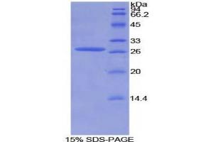 SDS-PAGE analysis of Mouse AXIN Protein. (Axin Protein)