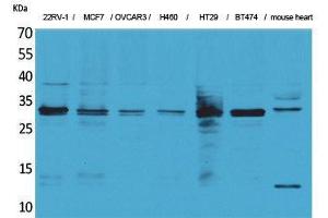 Western Blotting (WB) image for anti-Latexin (LXN) (Internal Region) antibody (ABIN3187682) (Latexin Antikörper  (Internal Region))