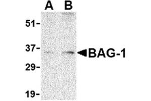 Image no. 1 for anti-BCL2-Associated Athanogene (BAG1) (N-Term) antibody (ABIN318740)