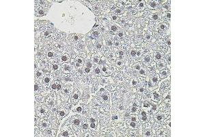 Immunohistochemistry of paraffin-embedded mouse liver using MYC antibody. (c-MYC Antikörper)