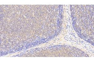 Detection of PLCd4 in Human Lymph node Tissue using Polyclonal Antibody to Phospholipase C Delta 4 (PLCd4) (PLCD4 Antikörper  (AA 1-250))